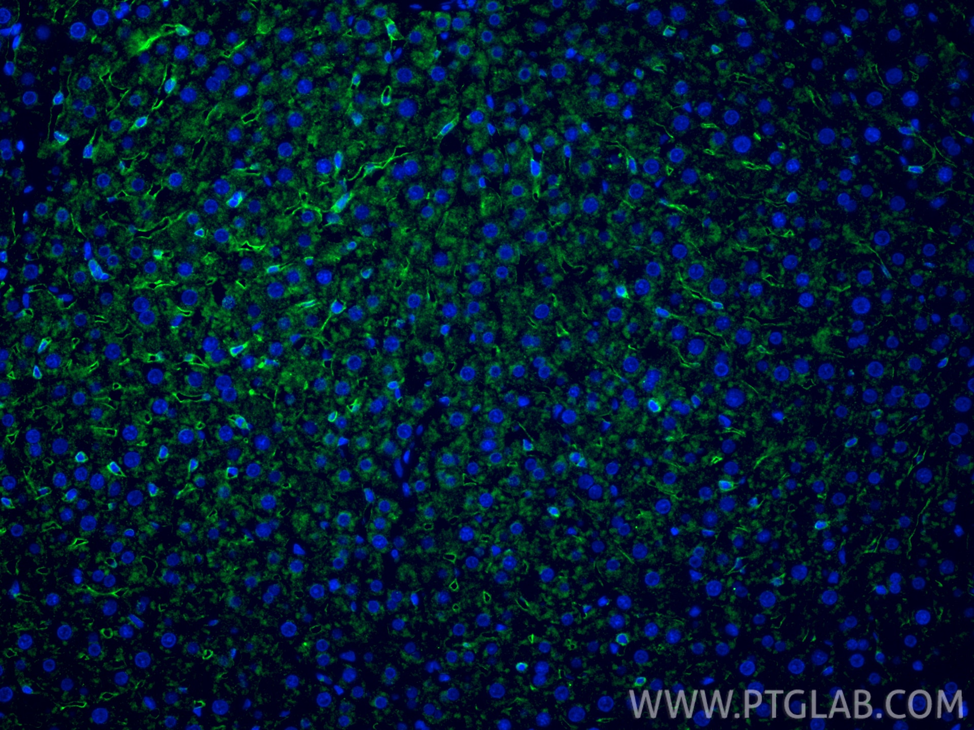 Immunofluorescence (IF) / fluorescent staining of rat liver tissue using LYVE1 Polyclonal antibody (28321-1-AP)