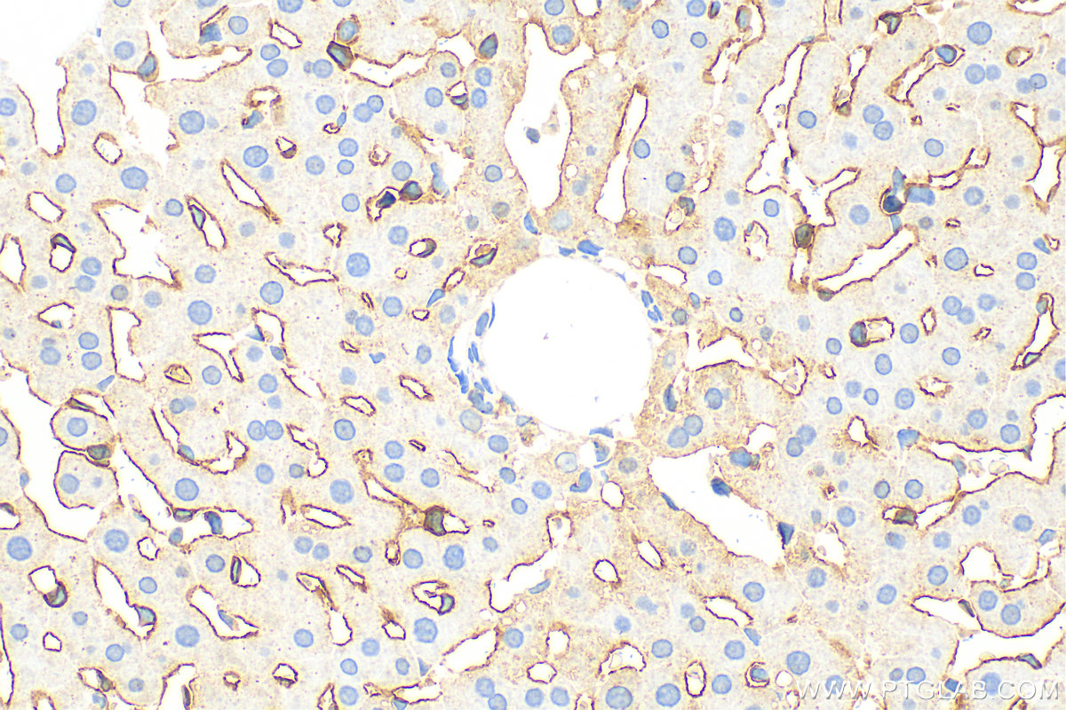 Immunohistochemistry (IHC) staining of rat liver tissue using LYVE1 Polyclonal antibody (28321-1-AP)
