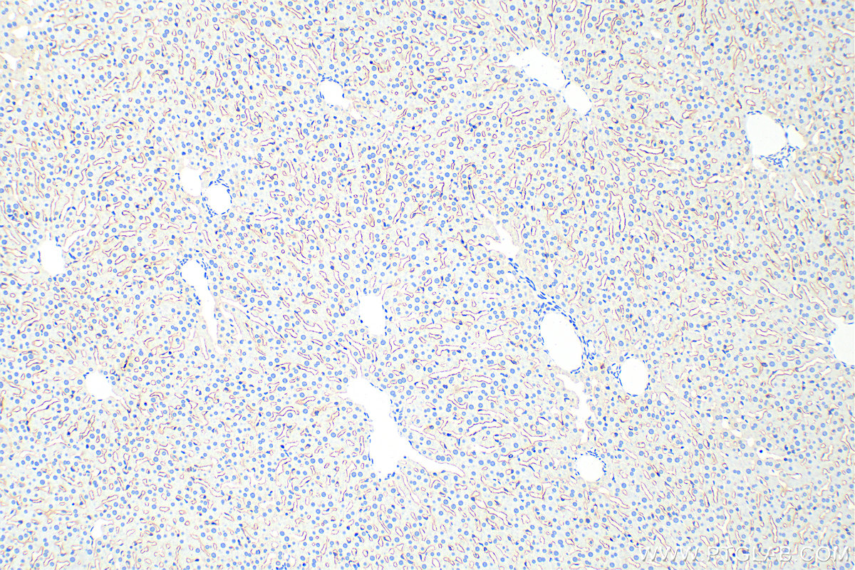 Immunohistochemistry (IHC) staining of rat liver tissue using LYVE1 Polyclonal antibody (28321-1-AP)