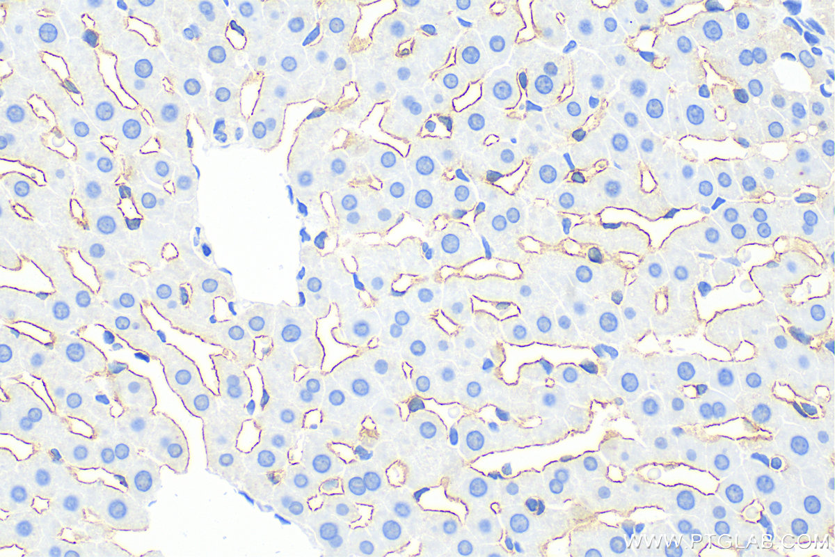 Immunohistochemistry (IHC) staining of rat liver tissue using LYVE1 Polyclonal antibody (28321-1-AP)