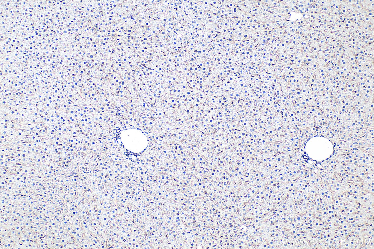Immunohistochemistry (IHC) staining of rat liver tissue using LYVE1 Polyclonal antibody (28321-1-AP)