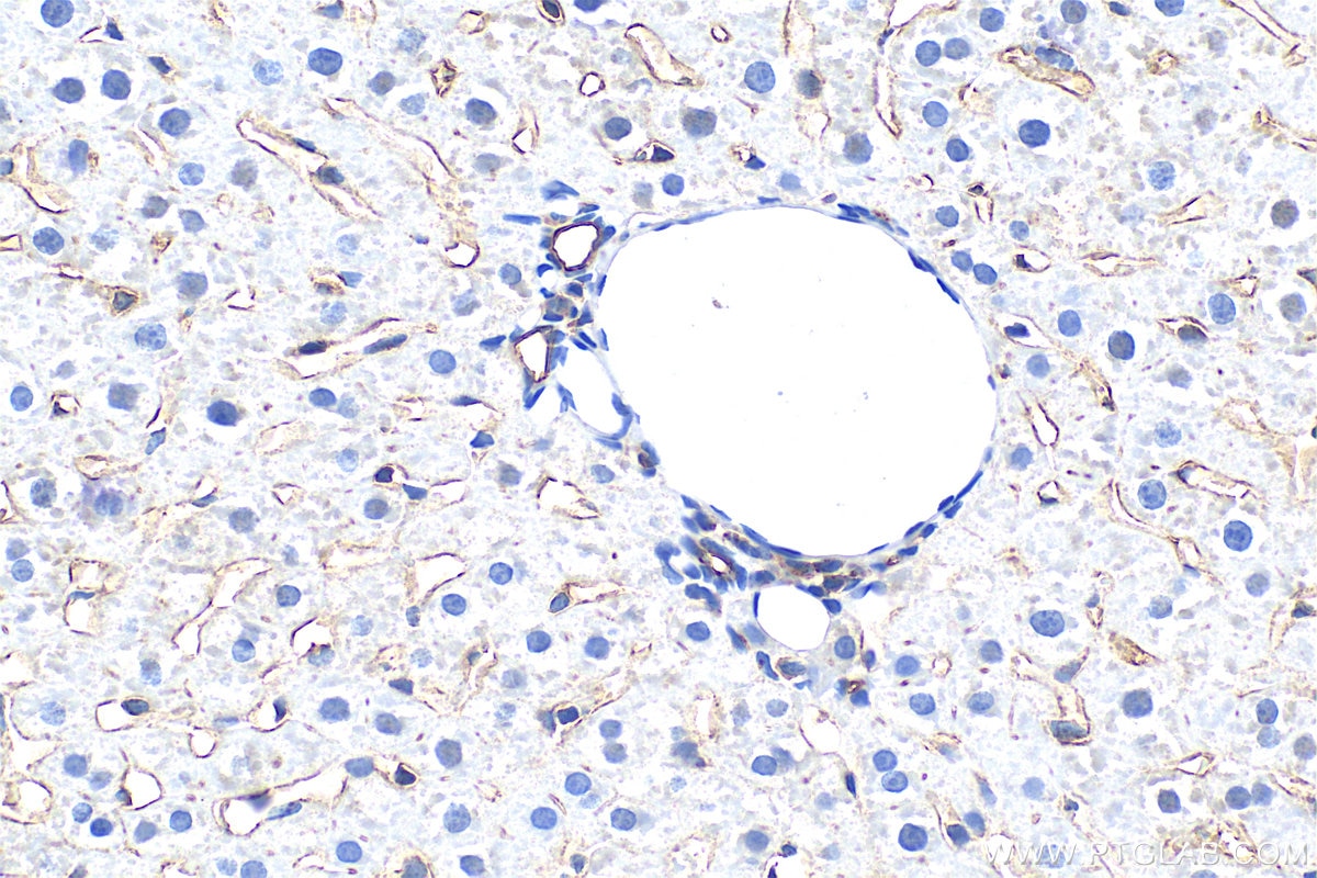Immunohistochemistry (IHC) staining of rat liver tissue using LYVE1 Polyclonal antibody (28321-1-AP)