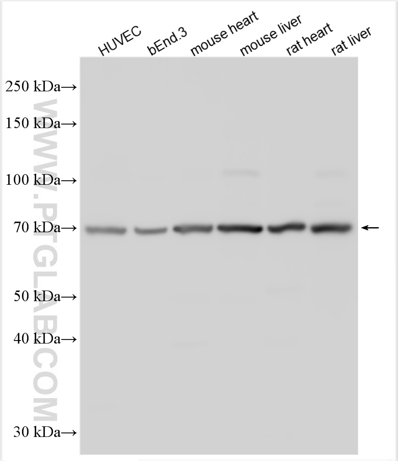 Western Blot (WB) analysis of various lysates using LYVE1 Polyclonal antibody (28321-1-AP)