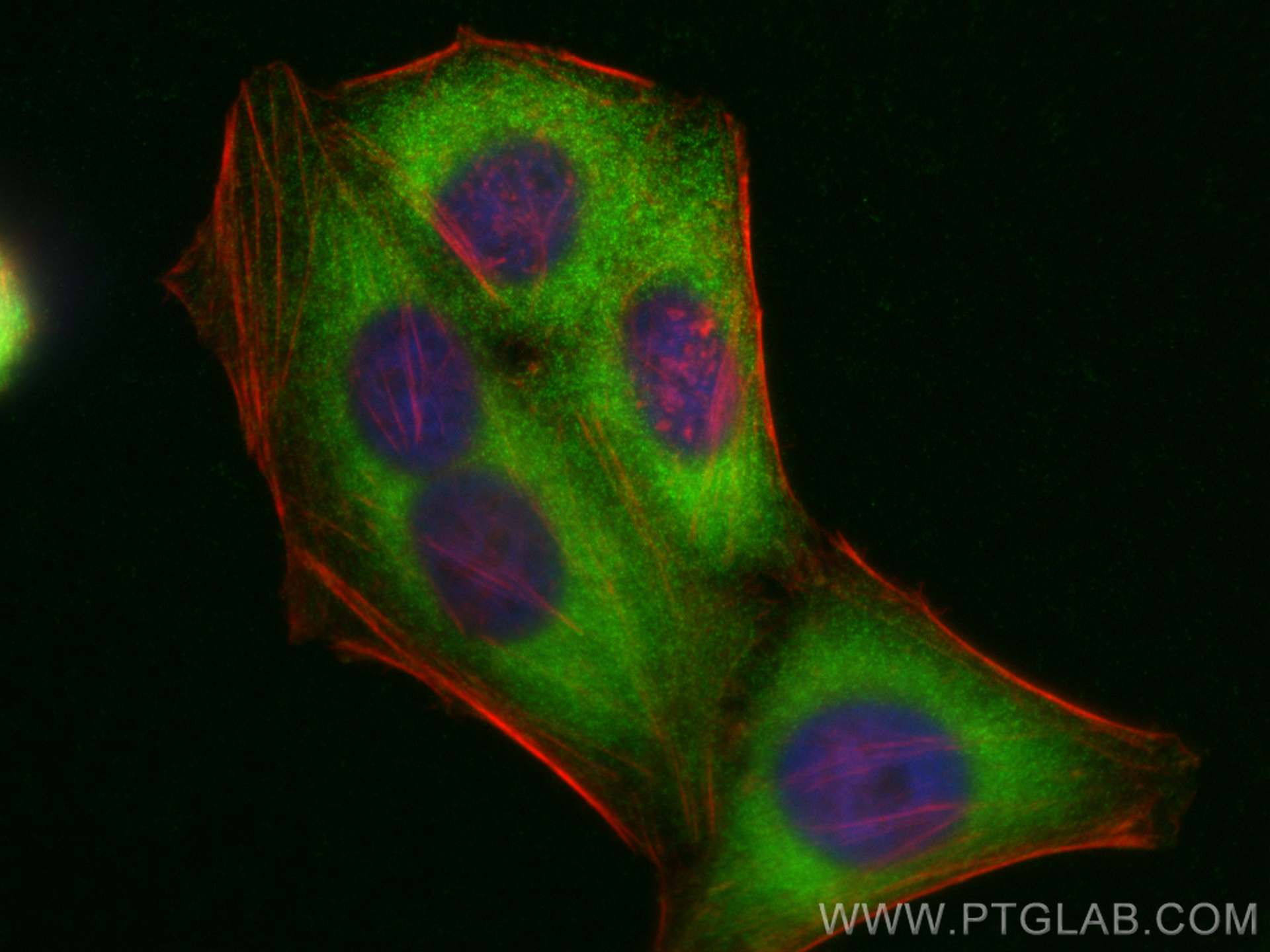 Immunofluorescence (IF) / fluorescent staining of HepG2 cells using LZTFL1 Polyclonal antibody (17073-1-AP)