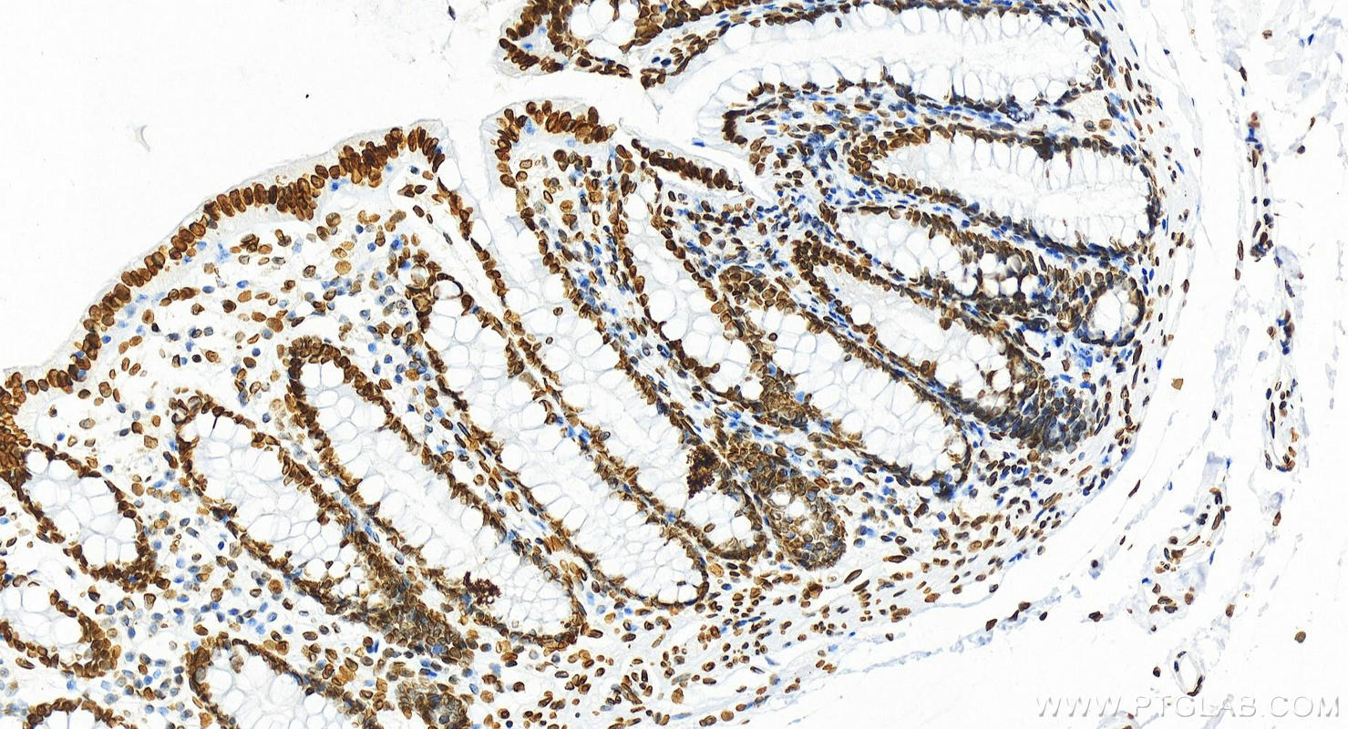 Immunohistochemistry (IHC) staining of human colon tissue using Lamin A/C Recombinant antibody (81042-1-RR)