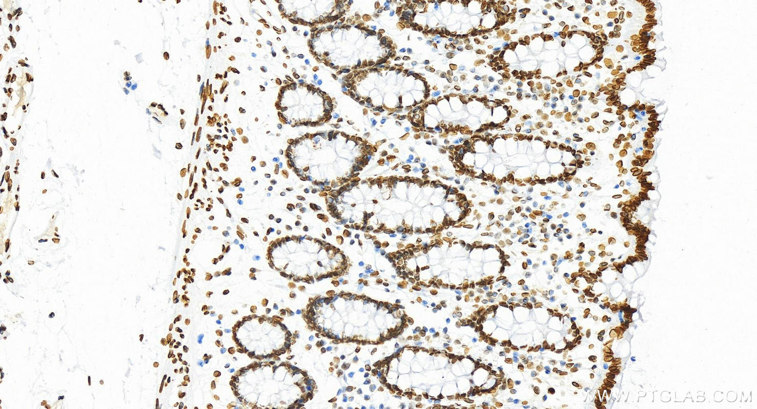 Immunohistochemistry (IHC) staining of human colon tissue using Lamin A/C Recombinant antibody (81042-1-RR)