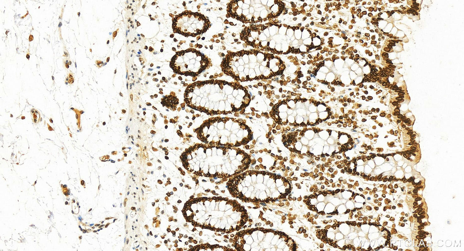 Immunohistochemistry (IHC) staining of human colon tissue using Lamin B1 Recombinant antibody (80906-1-RR)