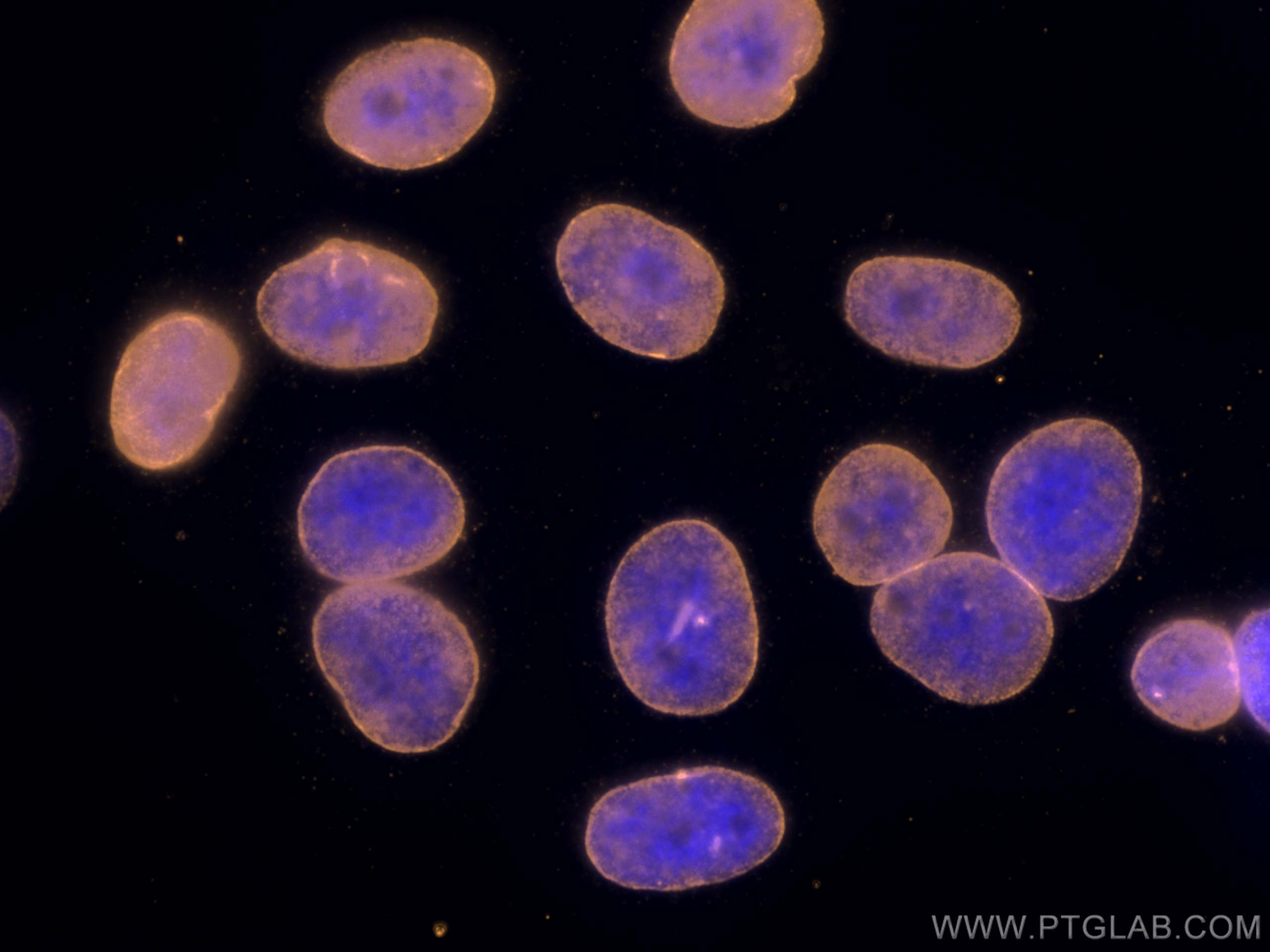 Immunofluorescence (IF) / fluorescent staining of HepG2 cells using CoraLite®555-conjugated Lamin B1 Monoclonal antibo (CL555-66095)
