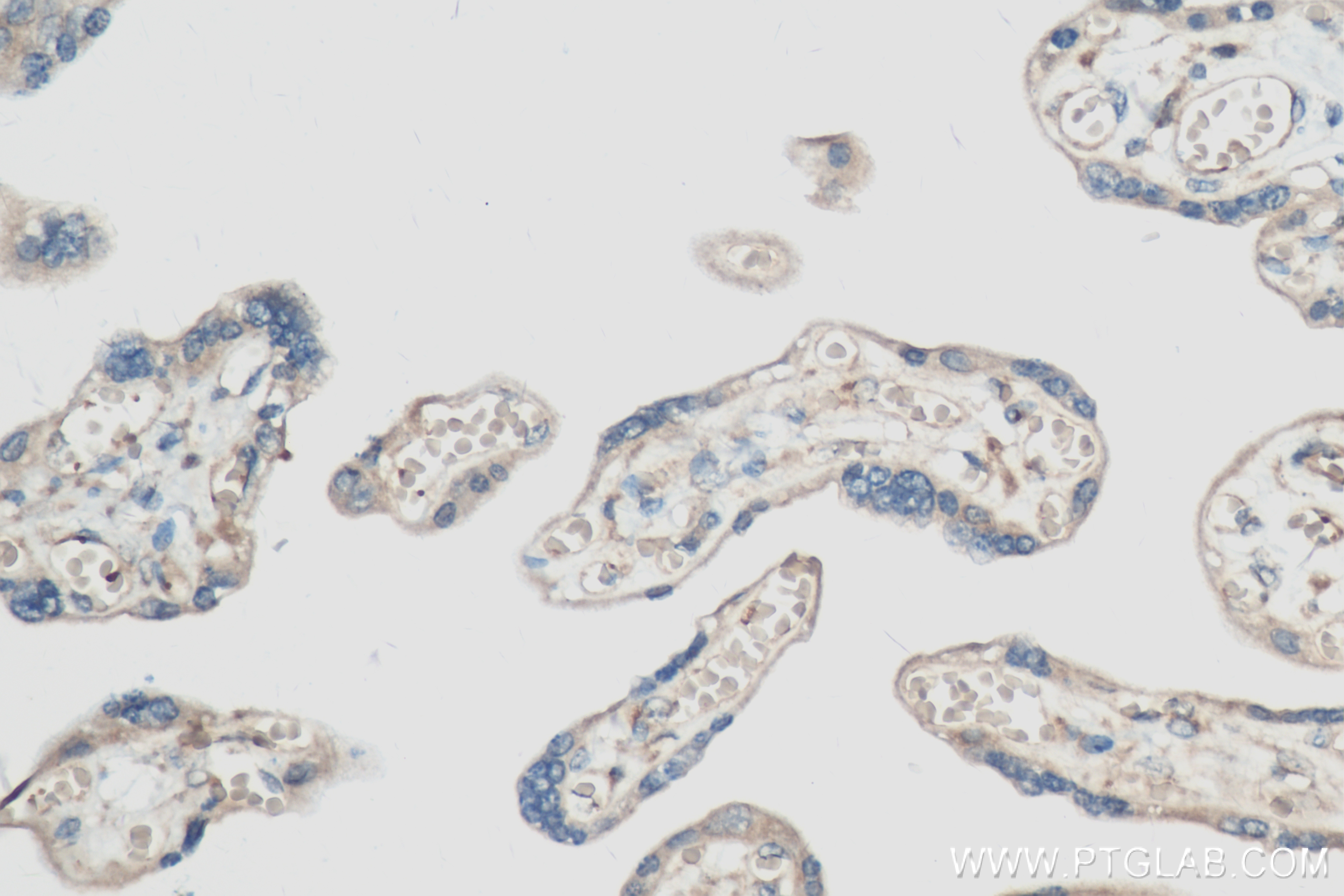 Immunohistochemistry (IHC) staining of human placenta tissue using Leptin Recombinant antibody (83655-3-RR)