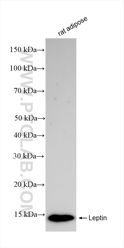 Western Blot (WB) analysis of rat adipose tissue using Leptin Recombinant antibody (83655-3-RR)