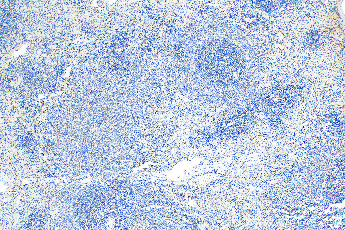 Immunohistochemistry (IHC) staining of rat spleen tissue using Lipocalin-2/NGAL Polyclonal antibody (31452-1-AP)