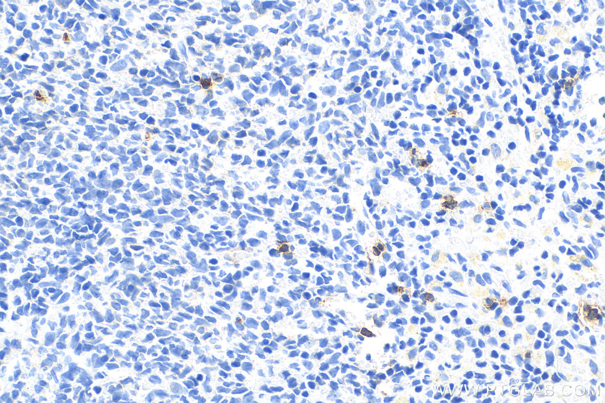 Immunohistochemistry (IHC) staining of rat spleen tissue using Lipocalin-2/NGAL Polyclonal antibody (31452-1-AP)