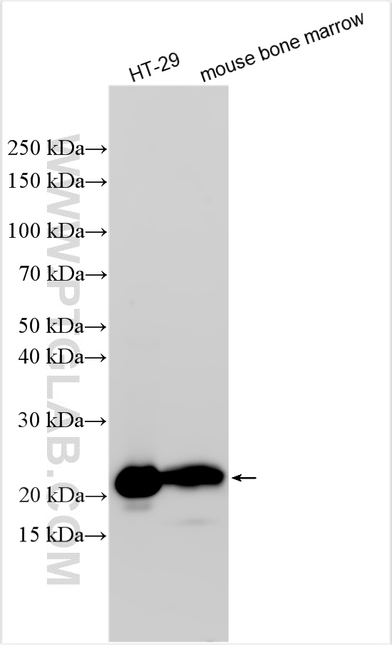 Western Blot (WB) analysis of various lysates using Lipocalin-2/NGAL Polyclonal antibody (31721-1-AP)