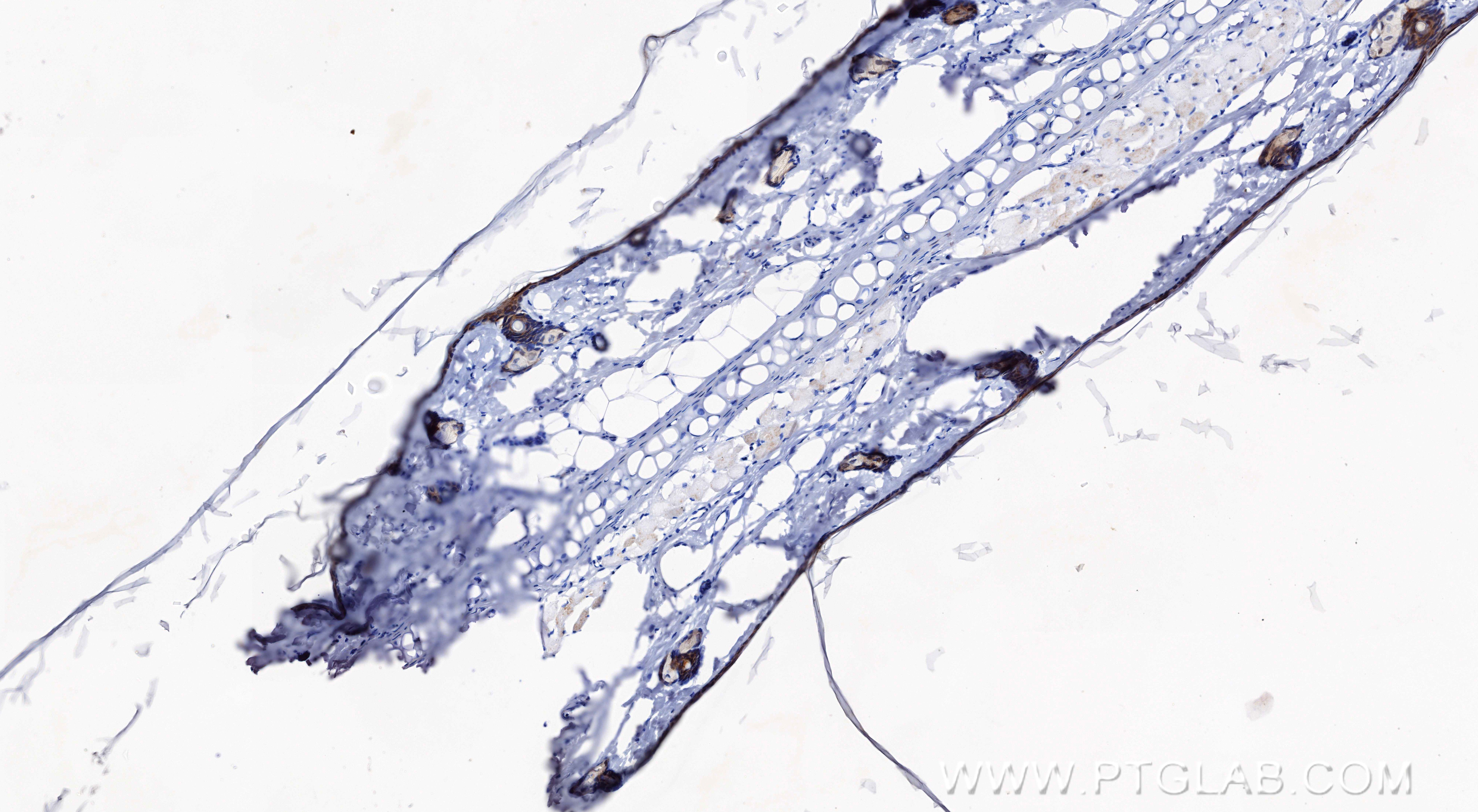 Immunohistochemistry (IHC) staining of rat skin tissue using Loricrin Recombinant monoclonal antibody (83865-1-RR)