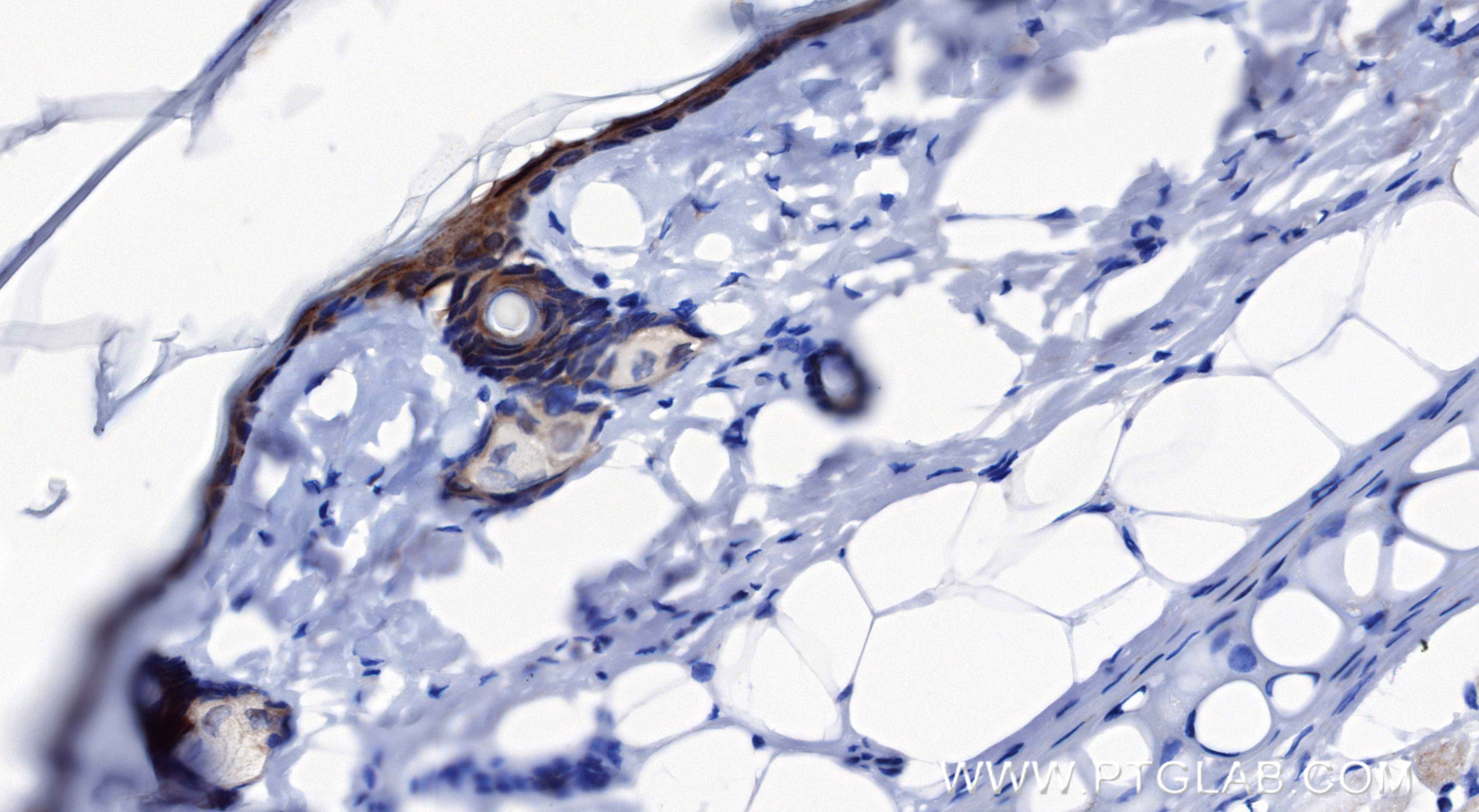 Immunohistochemistry (IHC) staining of rat skin tissue using Loricrin Recombinant monoclonal antibody (83865-1-RR)