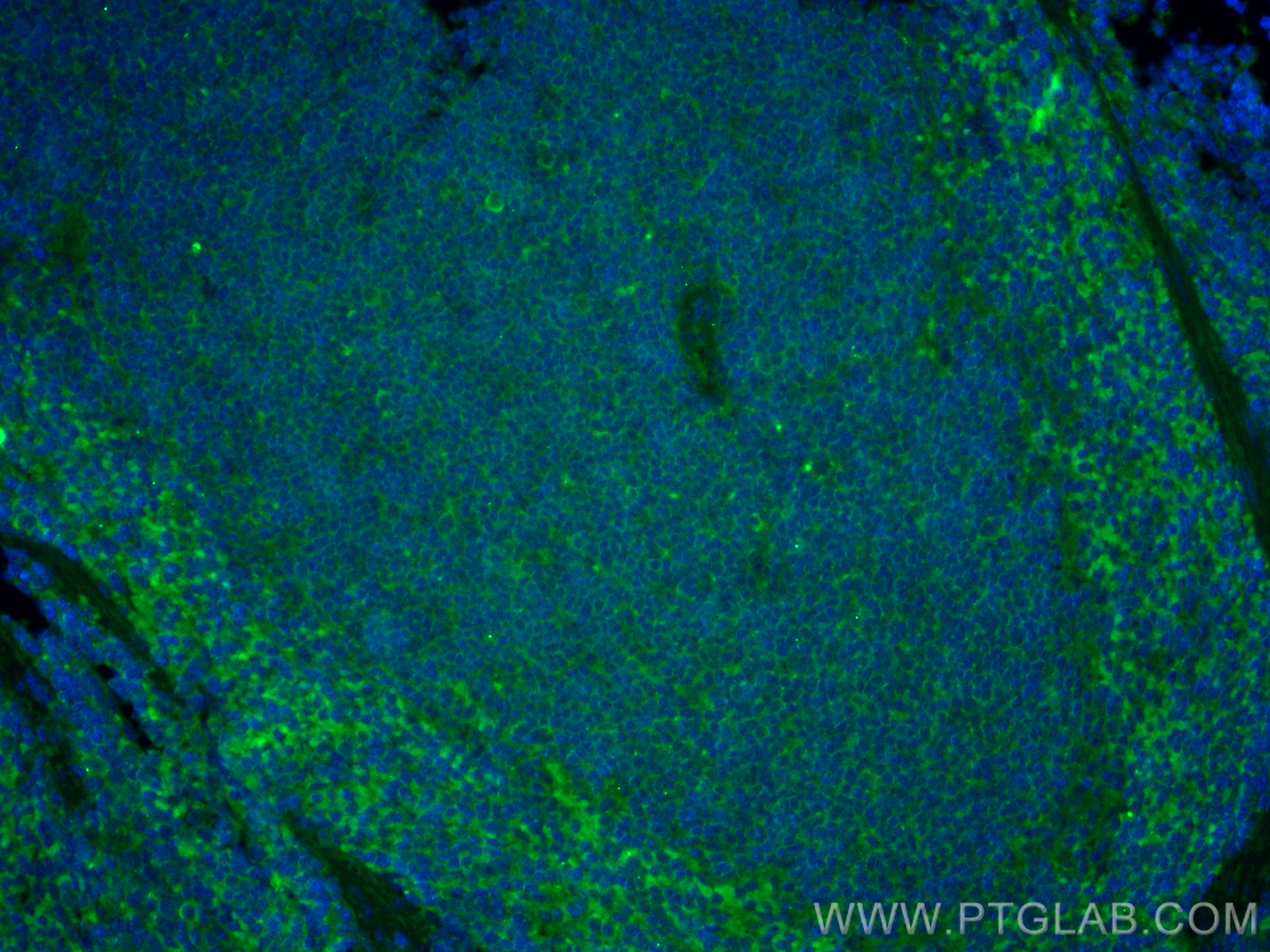 Immunofluorescence (IF) / fluorescent staining of mouse spleen tissue using CoraLite® Plus 488-conjugated Lumican Polyclonal a (CL488-10677)