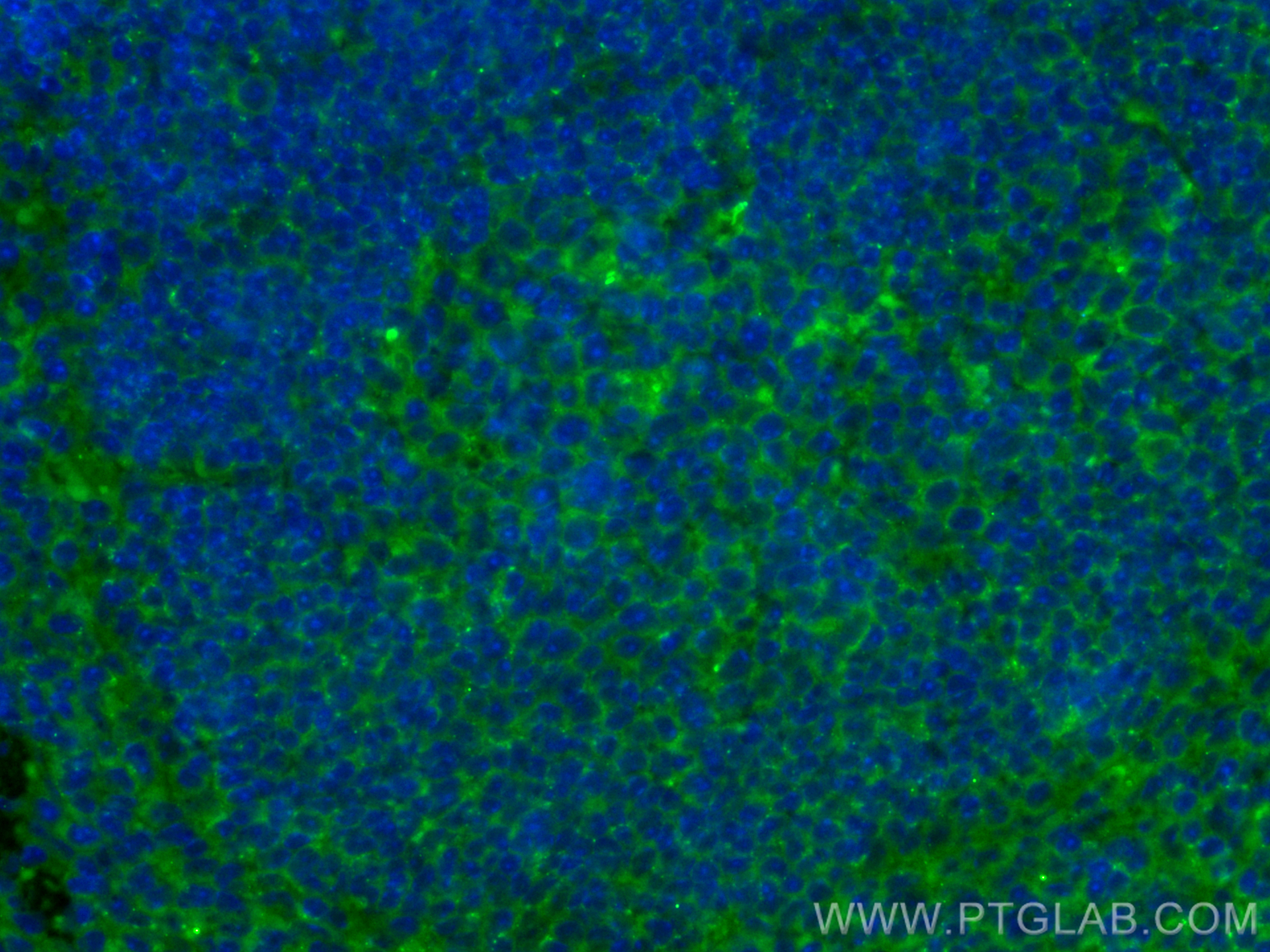 Immunofluorescence (IF) / fluorescent staining of mouse spleen tissue using CoraLite® Plus 488-conjugated Lumican Polyclonal a (CL488-10677)