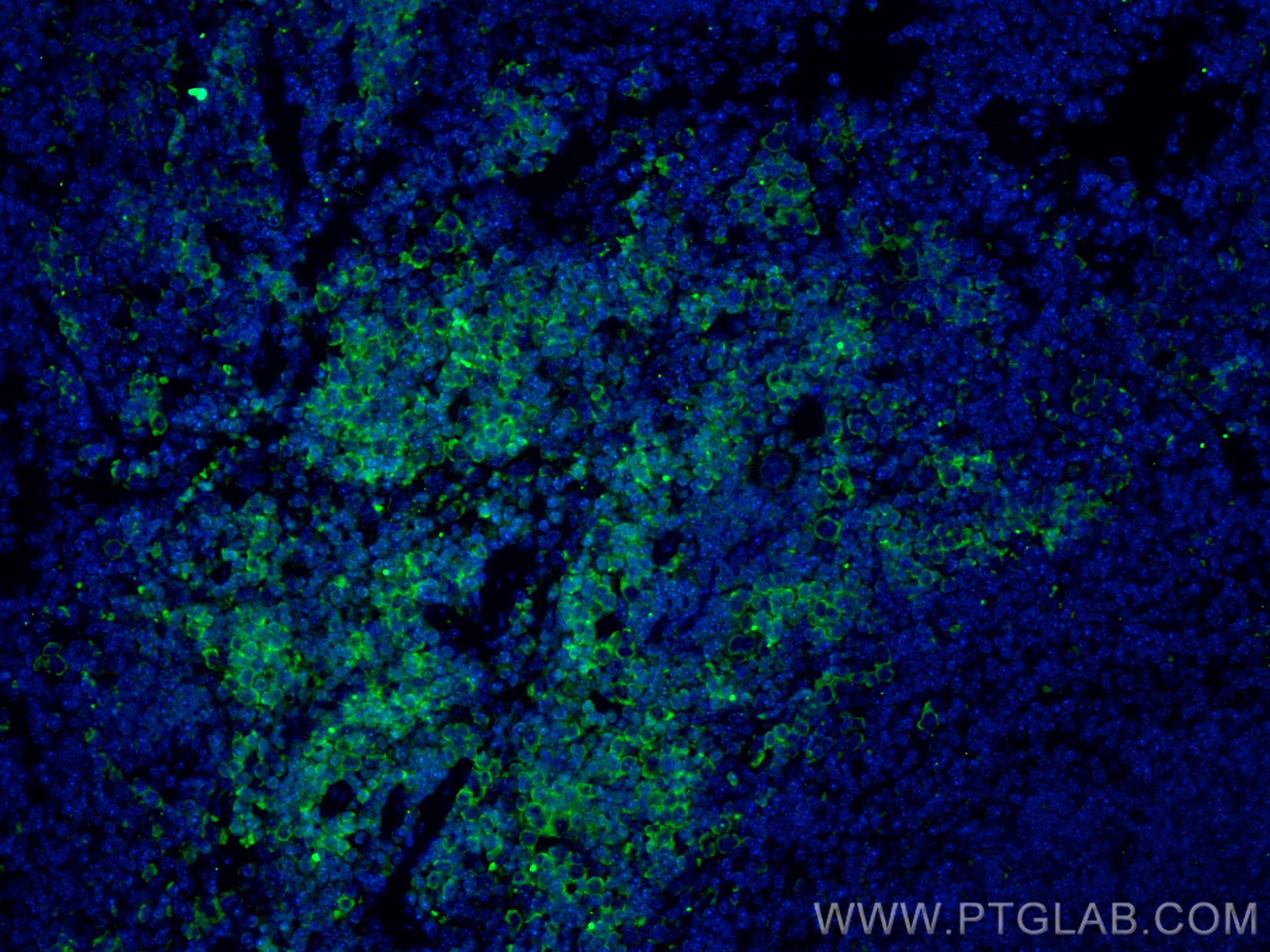 Immunofluorescence (IF) / fluorescent staining of mouse spleen tissue using CoraLite® Plus 488-conjugated Lumican Polyclonal a (CL488-10677)