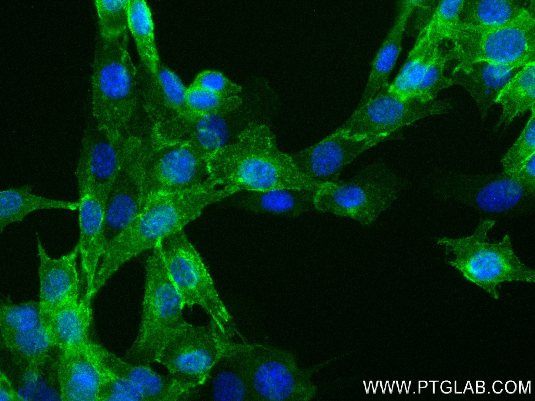 Immunofluorescence (IF) / fluorescent staining of C2C12 cells using M-cadherin Recombinant antibody (84440-5-RR)