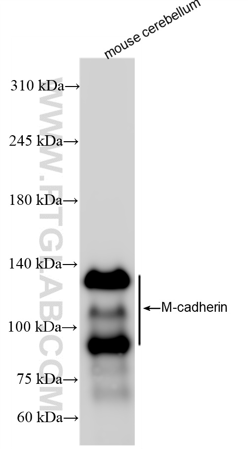 M-cadherin