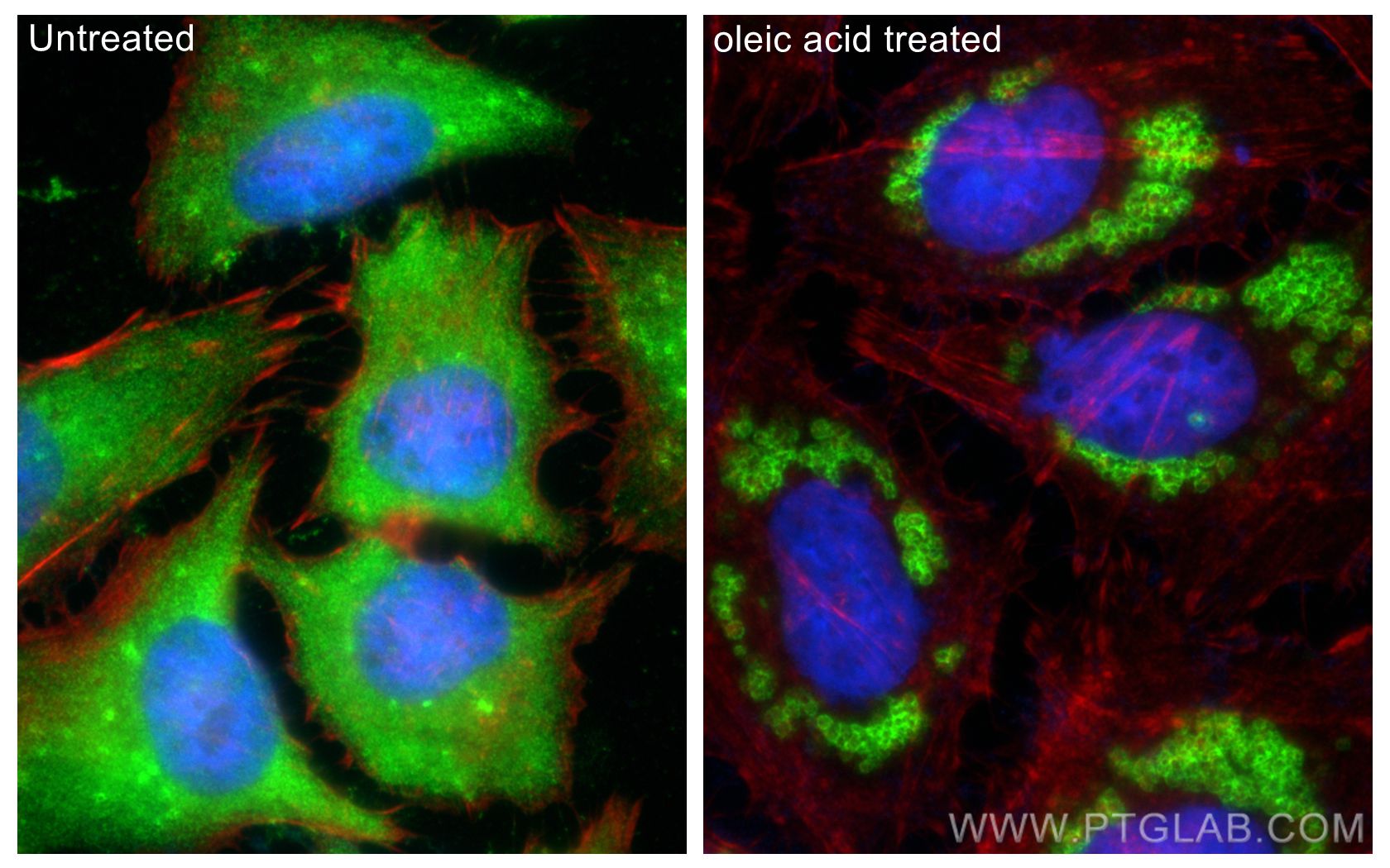 Immunofluorescence (IF) / fluorescent staining of HeLa cells using TIP47 Polyclonal antibody (10694-1-AP)