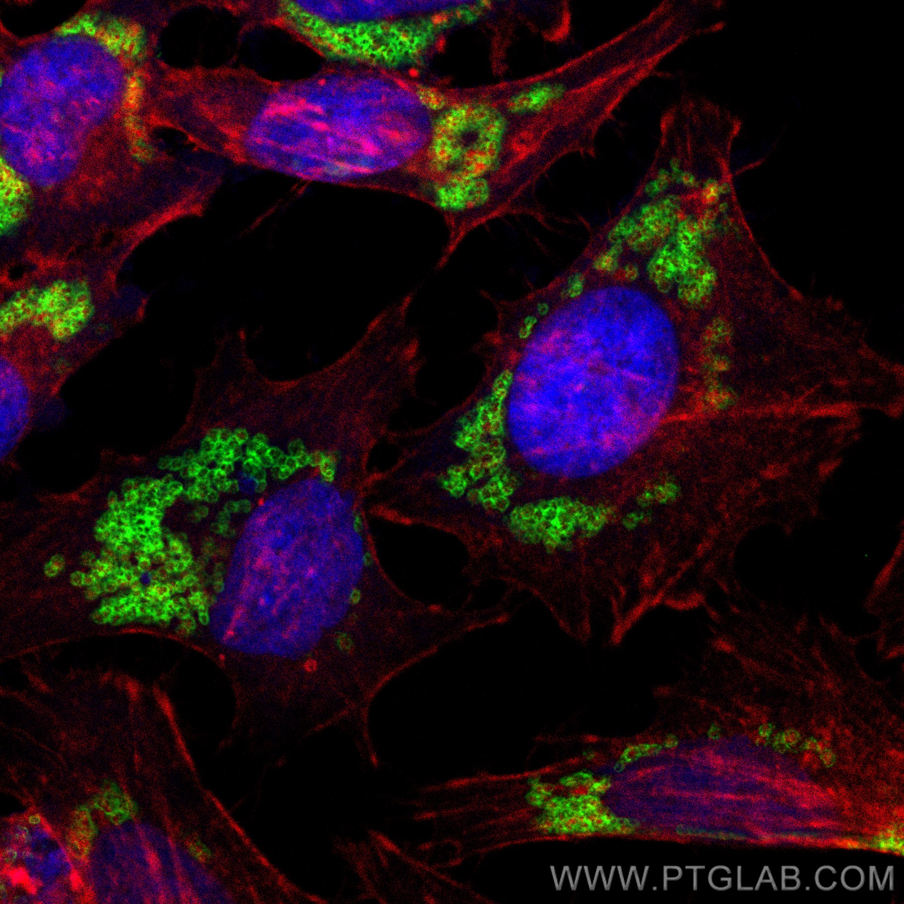 Immunofluorescence (IF) / fluorescent staining of HeLa cells using Perilipin 3/TIP47 Polyclonal antibody (10694-1-AP)