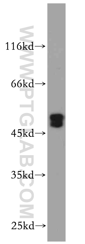 MAB21L2