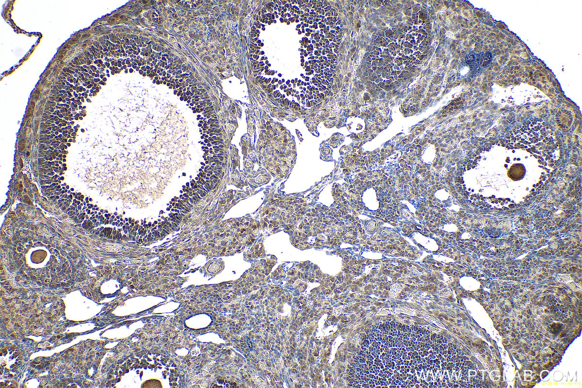 Immunohistochemistry (IHC) staining of mouse ovary tissue using MAD2L1 Polyclonal antibody (10337-1-AP)