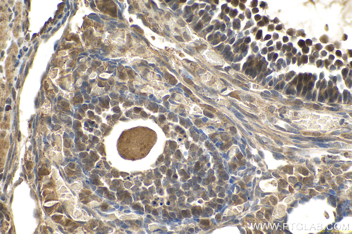 Immunohistochemistry (IHC) staining of mouse ovary tissue using MAD2L1 Polyclonal antibody (10337-1-AP)