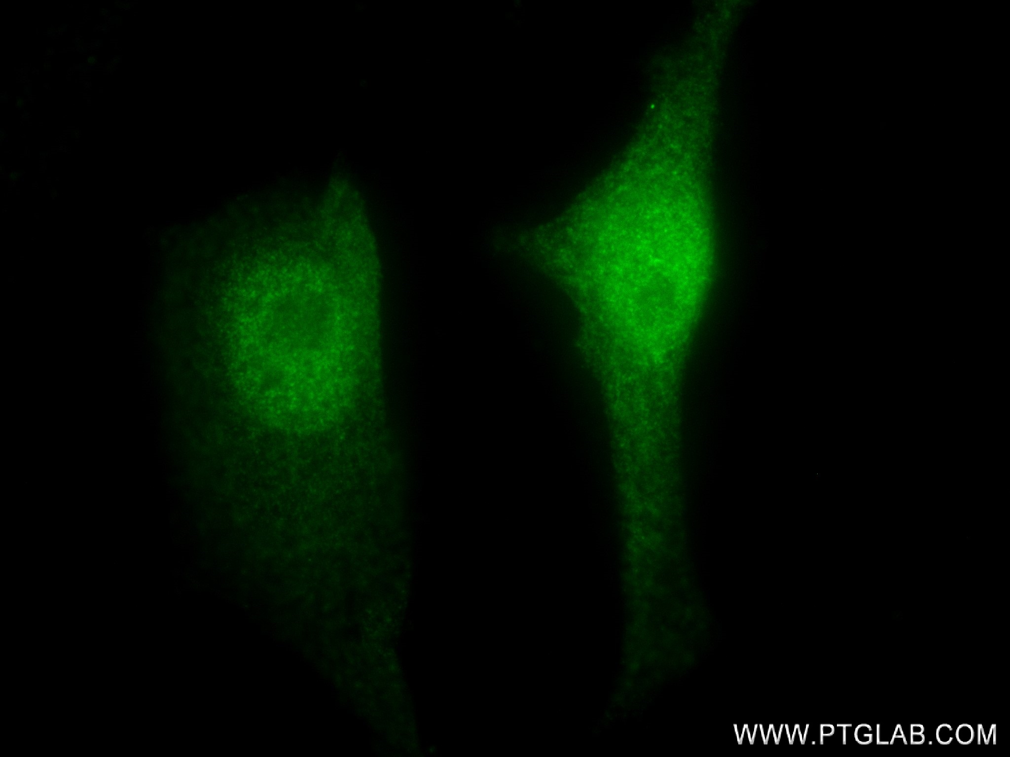 Immunofluorescence (IF) / fluorescent staining of HeLa cells using MAEA Recombinant antibody (83267-4-RR)