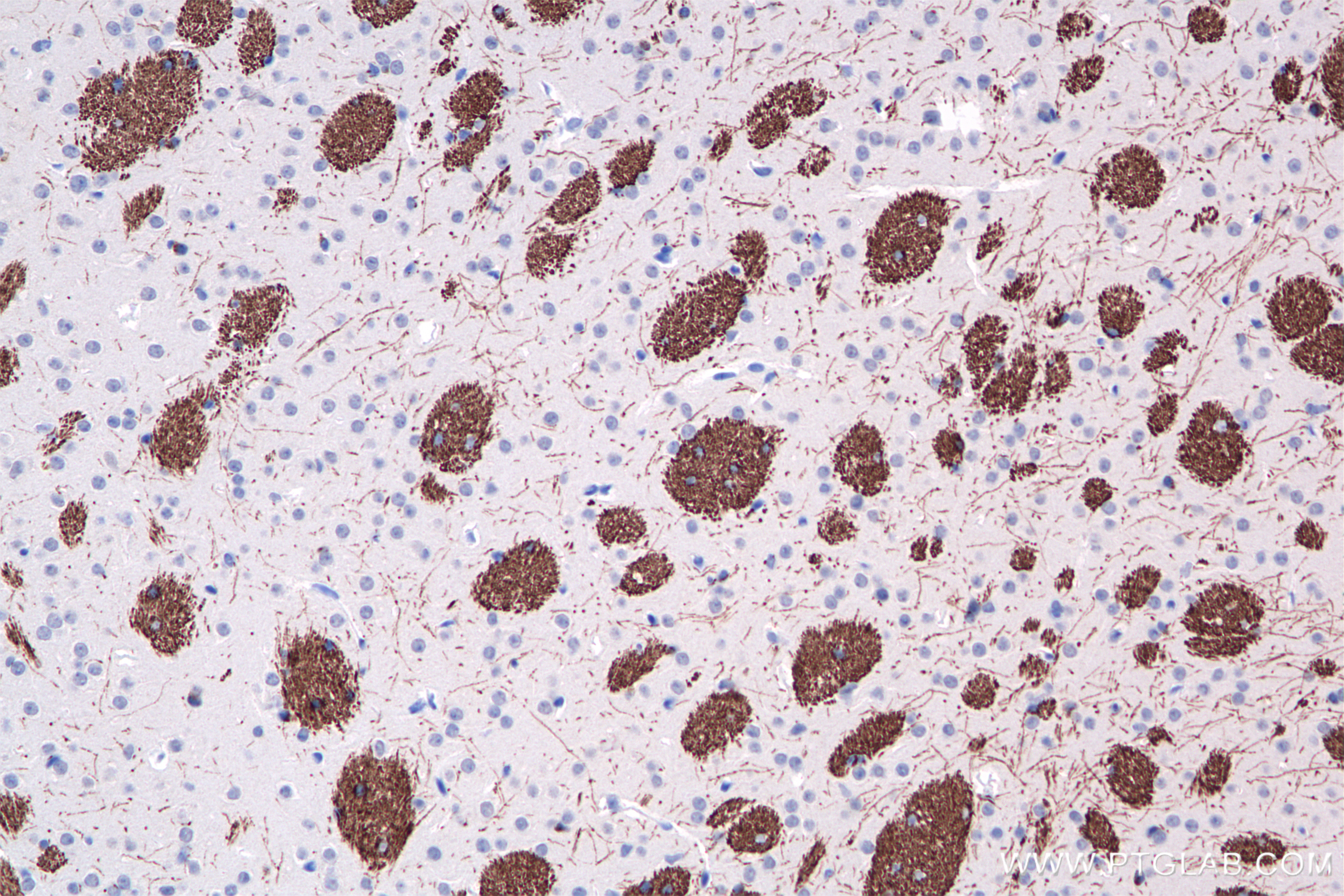 Immunohistochemistry (IHC) staining of mouse brain tissue using MAG Recombinant antibody (86097-1-RR)