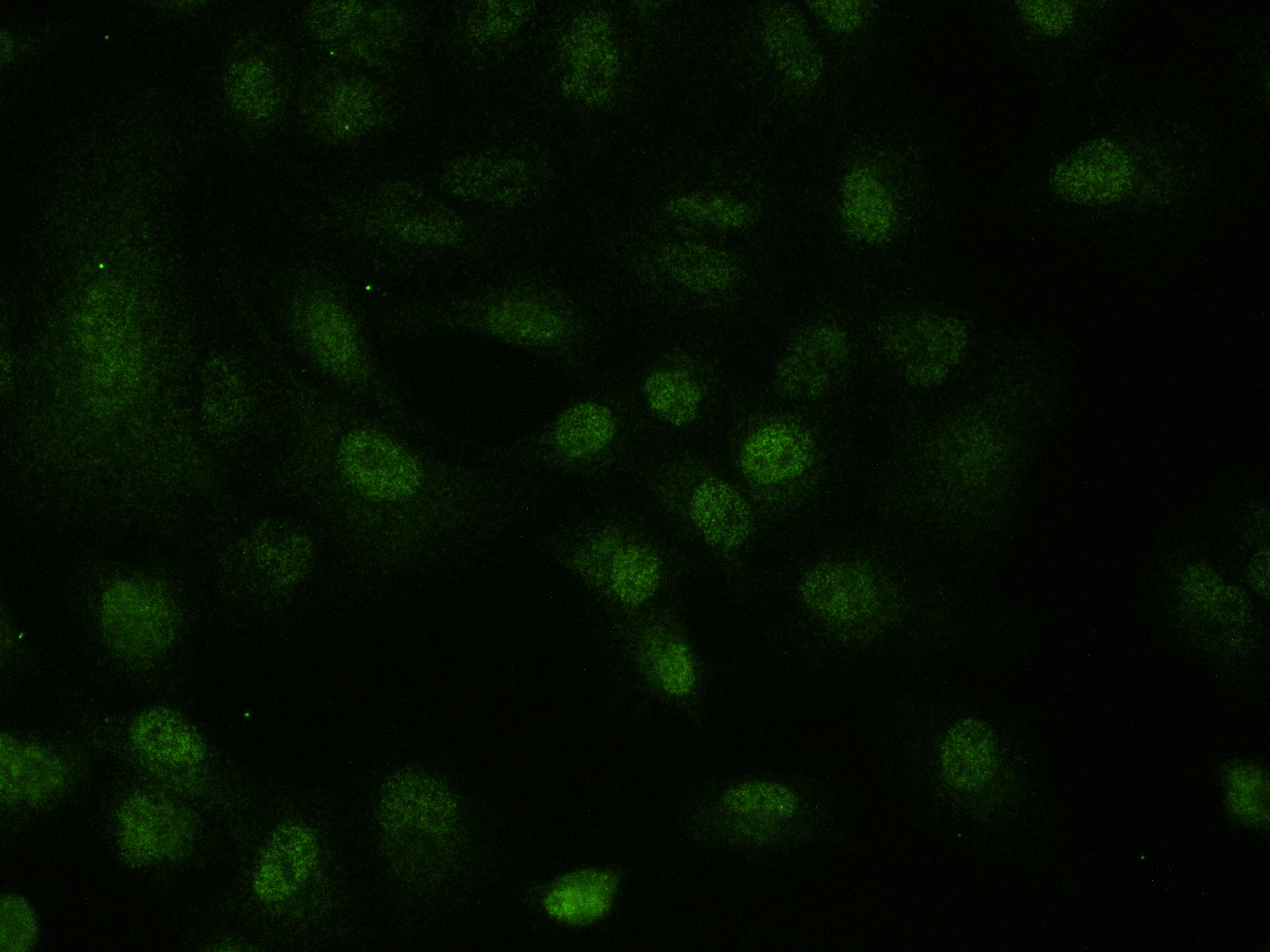 Immunofluorescence (IF) / fluorescent staining of A549 cells using MAGEA3 Recombinant antibody (83480-5-RR)