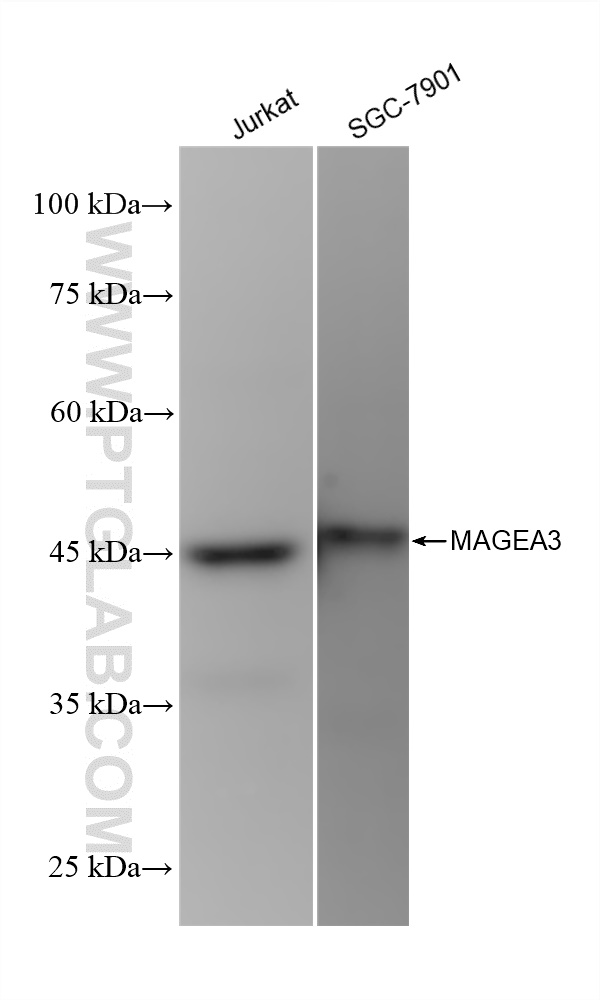 MAGEA3