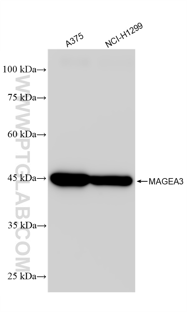 Western Blot (WB) analysis of various lysates using MAGEA3 Recombinant antibody (83480-5-RR)