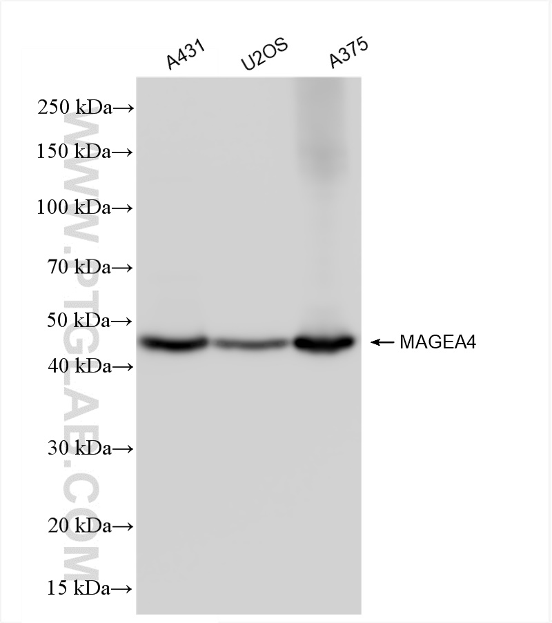 Western Blot (WB) analysis of various lysates using MAGEA4 Recombinant antibody (84248-4-RR)