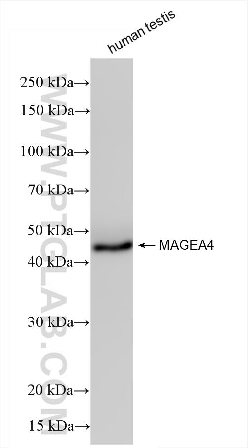 Western Blot (WB) analysis of human testis tissue using MAGEA4 Recombinant antibody (84248-4-RR)