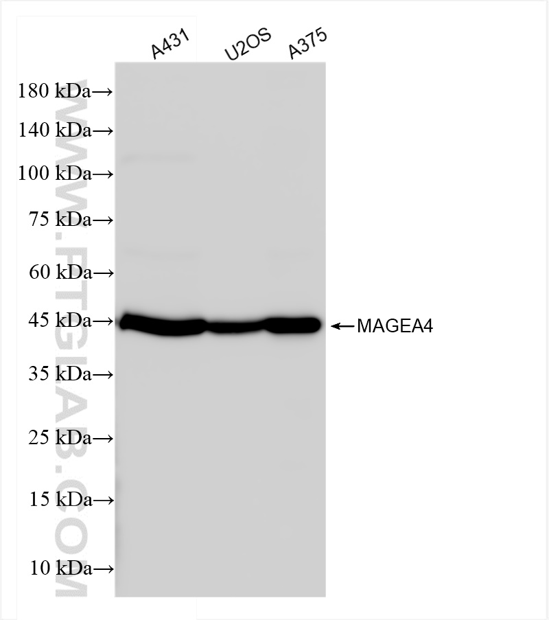 Western Blot (WB) analysis of various lysates using MAGEA4 Recombinant antibody (84248-6-RR)