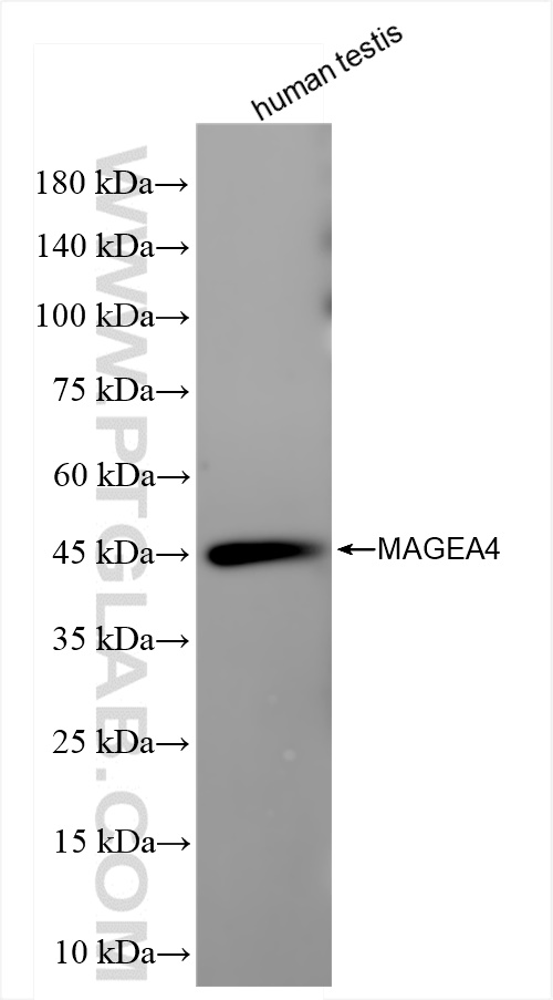 Western Blot (WB) analysis of human testis tissue using MAGEA4 Recombinant antibody (84248-6-RR)