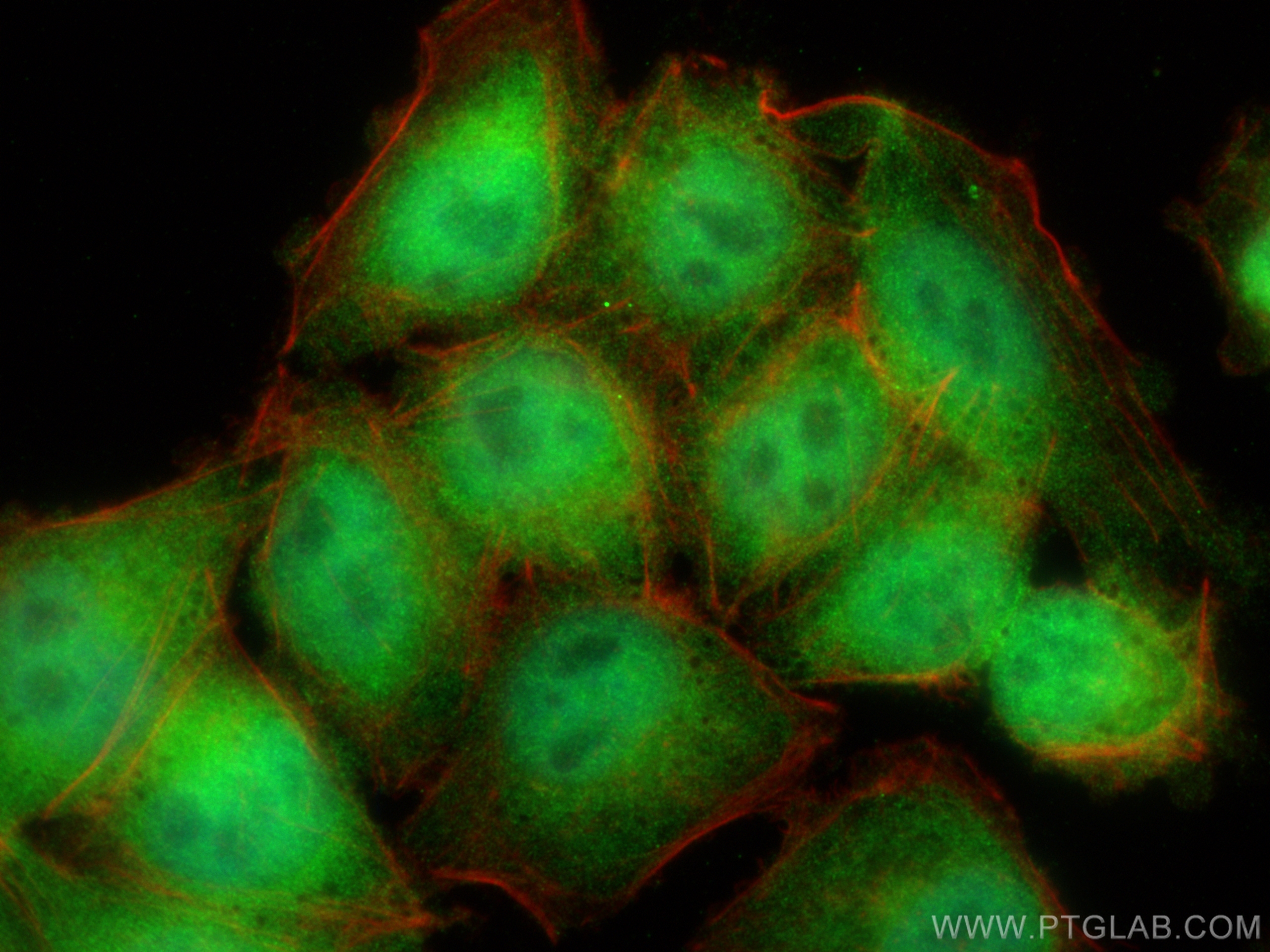 Immunofluorescence (IF) / fluorescent staining of A375 cells using MAGEA6 Polyclonal antibody (14602-1-AP)