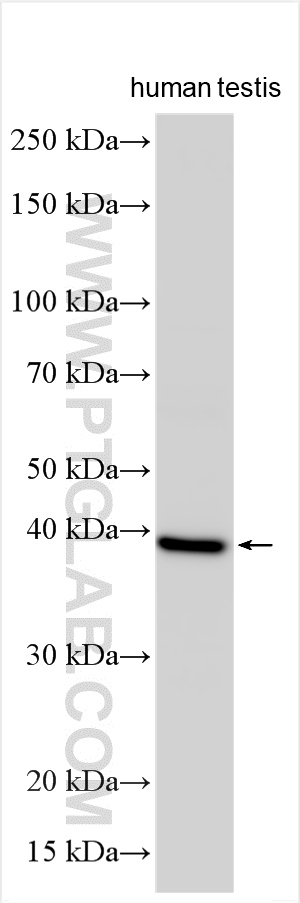 Western Blot (WB) analysis of various lysates using MAGEA9 Polyclonal antibody (14967-1-AP)