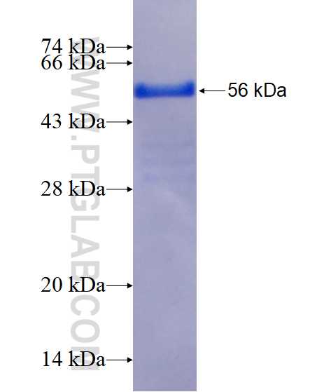 MAGEB1 fusion protein Ag14595 SDS-PAGE