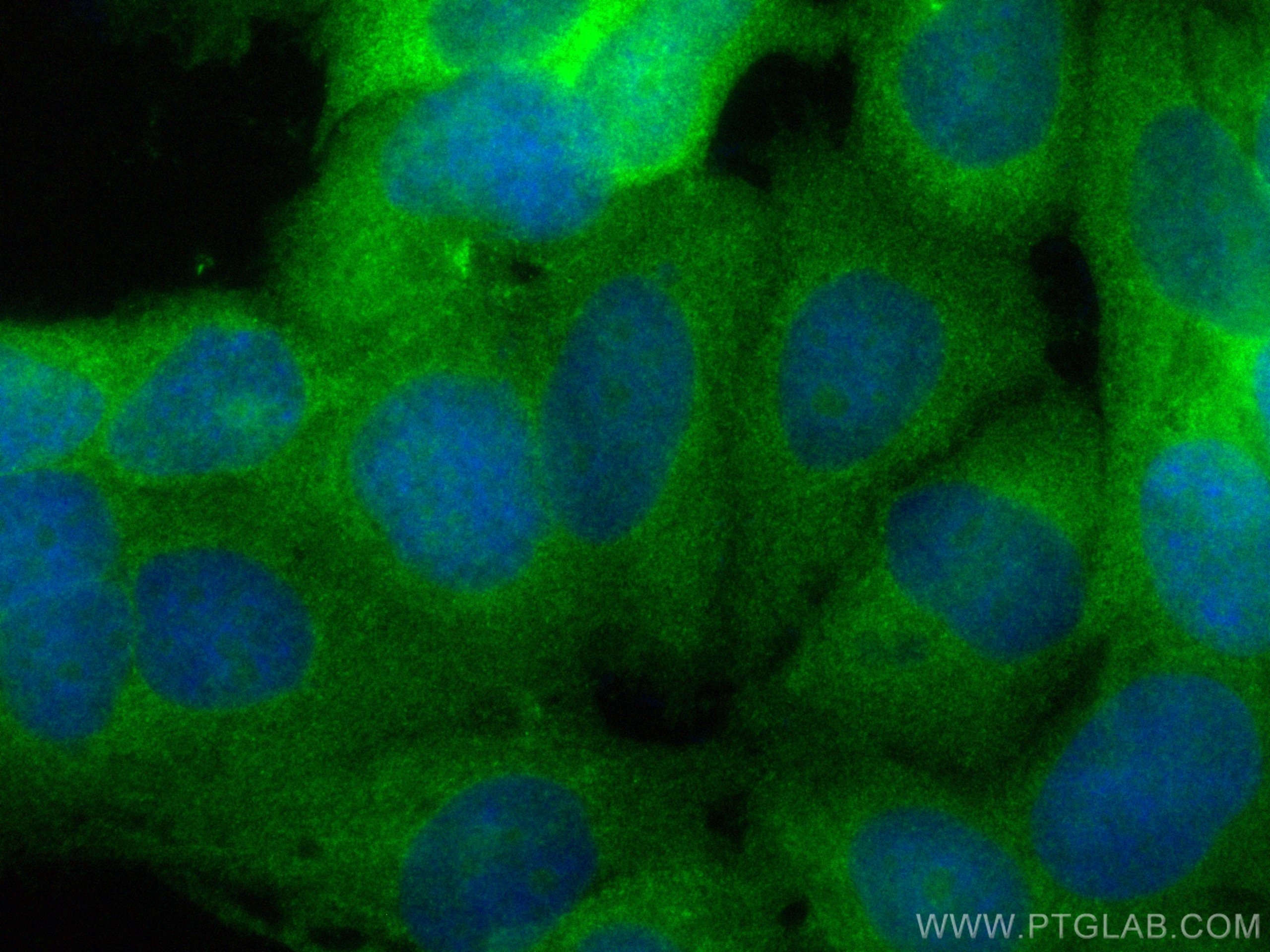 Immunofluorescence (IF) / fluorescent staining of MCF-7 cells using CoraLite® Plus 488-conjugated MAGED2 Polyclonal an (CL488-15252)