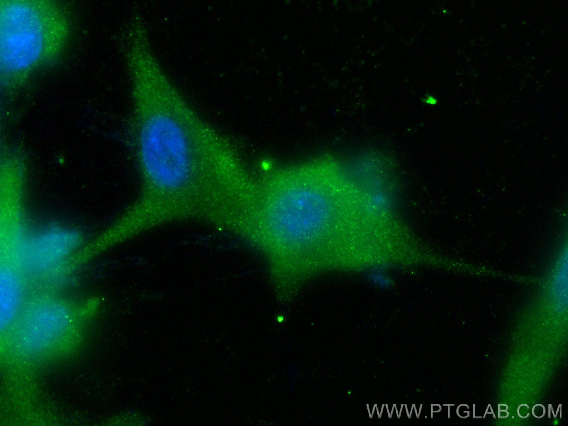 Immunofluorescence (IF) / fluorescent staining of U-87 MG cells using MAGI2 Polyclonal antibody (25189-1-AP)