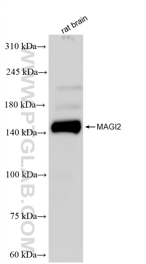 Western Blot (WB) analysis of rat brain tissue using MAGI2 Recombinant antibody (83561-6-RR)