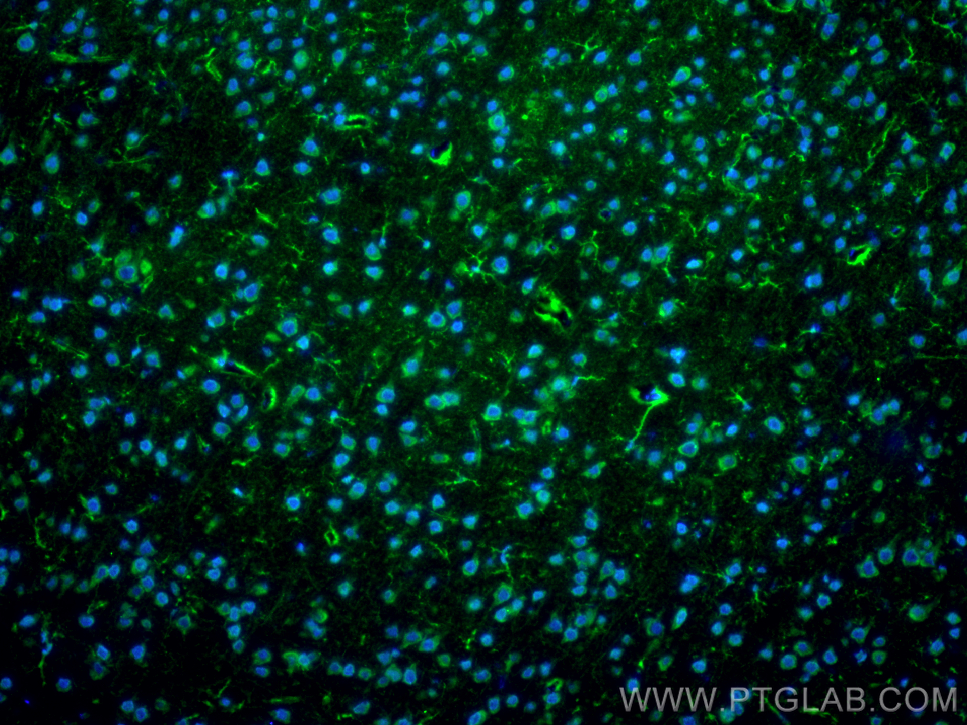 Immunofluorescence (IF) / fluorescent staining of mouse brain tissue using MAGT1 Polyclonal antibody (17430-1-AP)