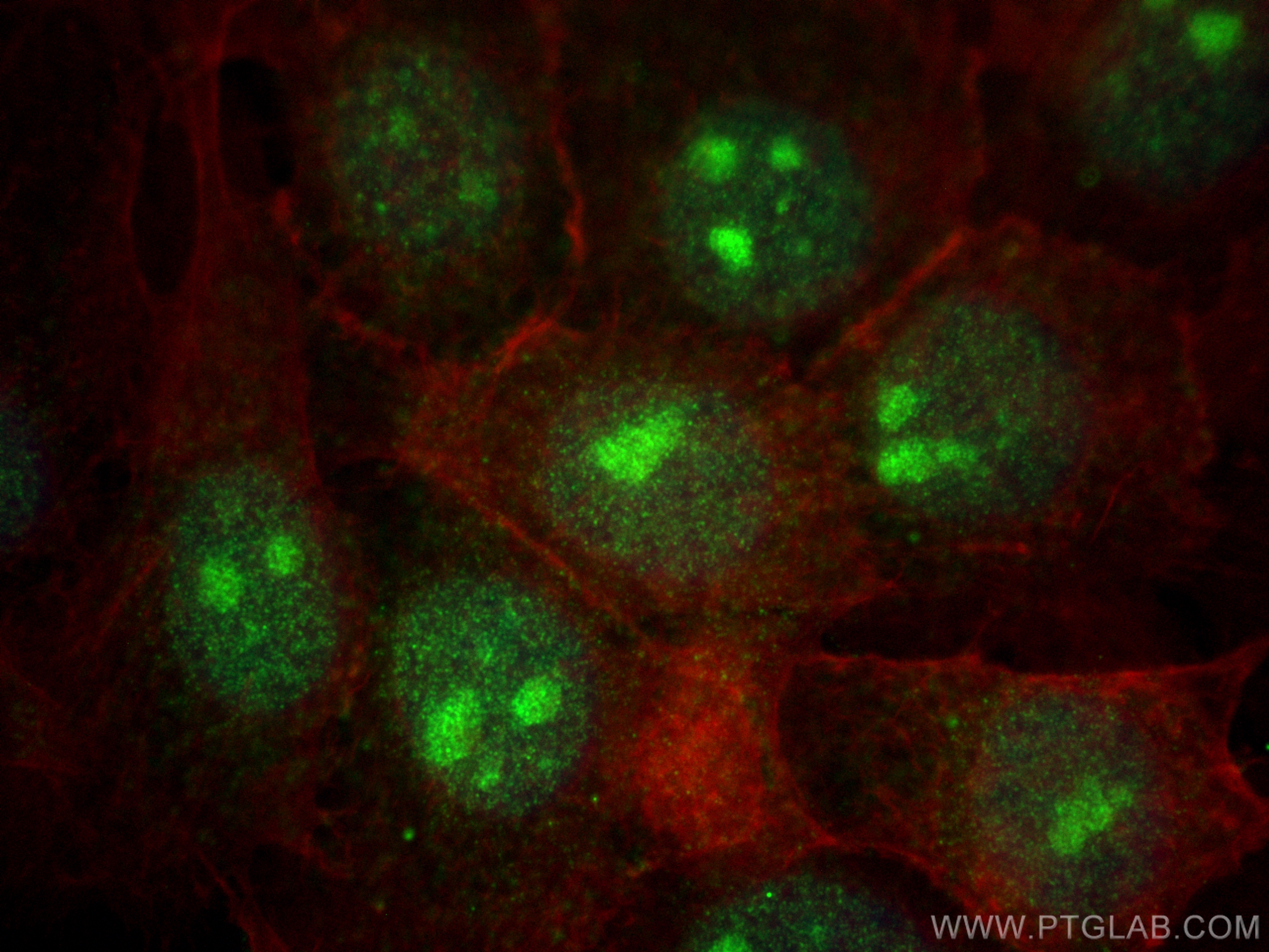 Immunofluorescence (IF) / fluorescent staining of A431 cells using MAK16 Polyclonal antibody (17505-1-AP)