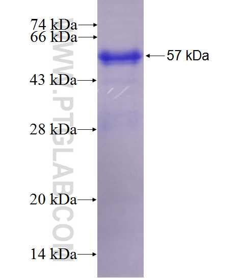 MALRD1 fusion protein Ag27535 SDS-PAGE