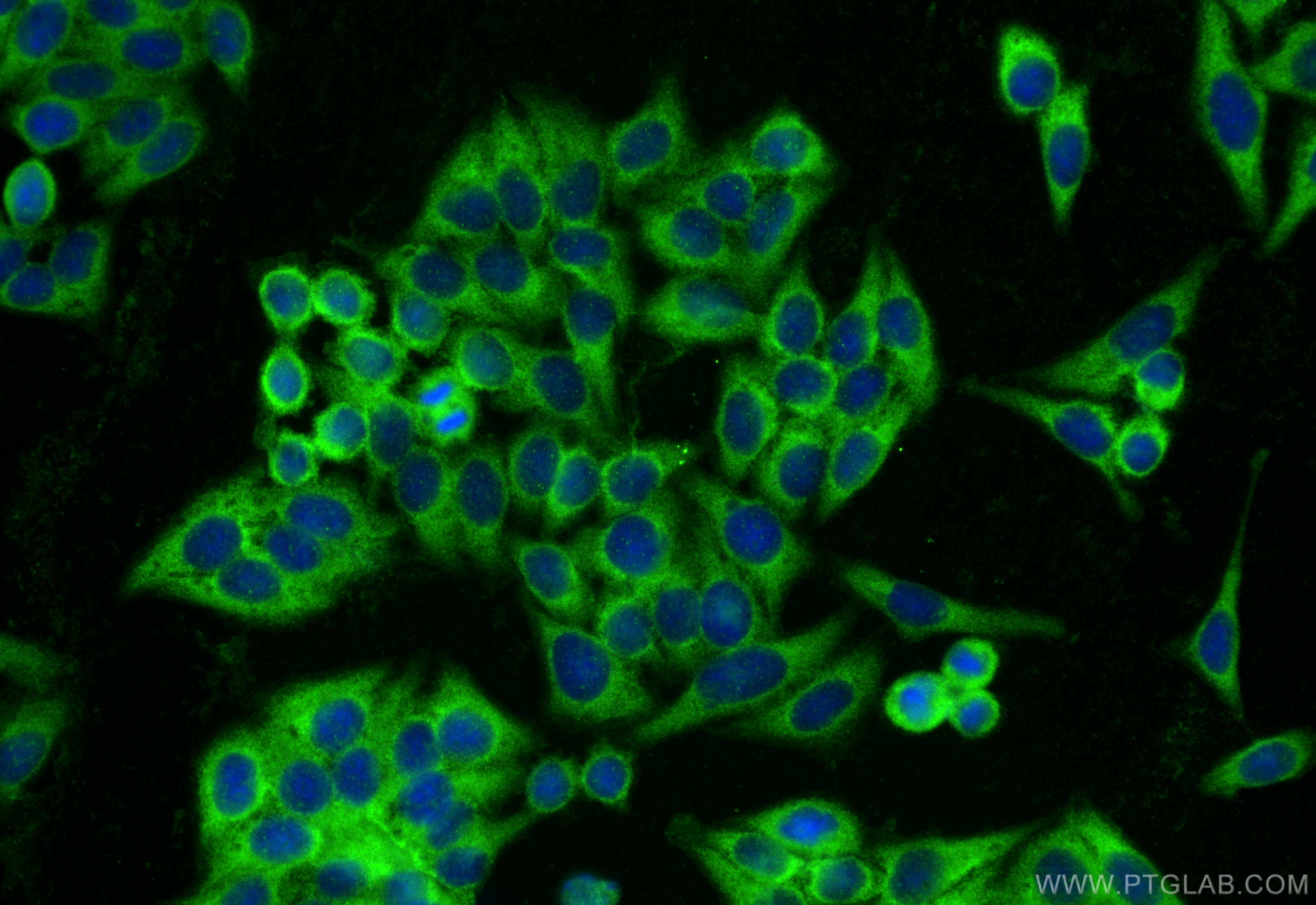 Immunofluorescence (IF) / fluorescent staining of HepG2 cells using MALT1 Polyclonal antibody (11660-1-AP)