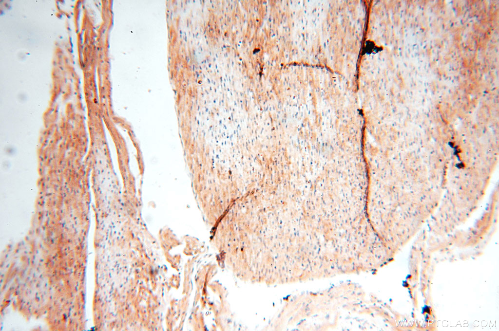 Immunohistochemistry (IHC) staining of human heart tissue using MAN1A2 Polyclonal antibody (14049-1-AP)