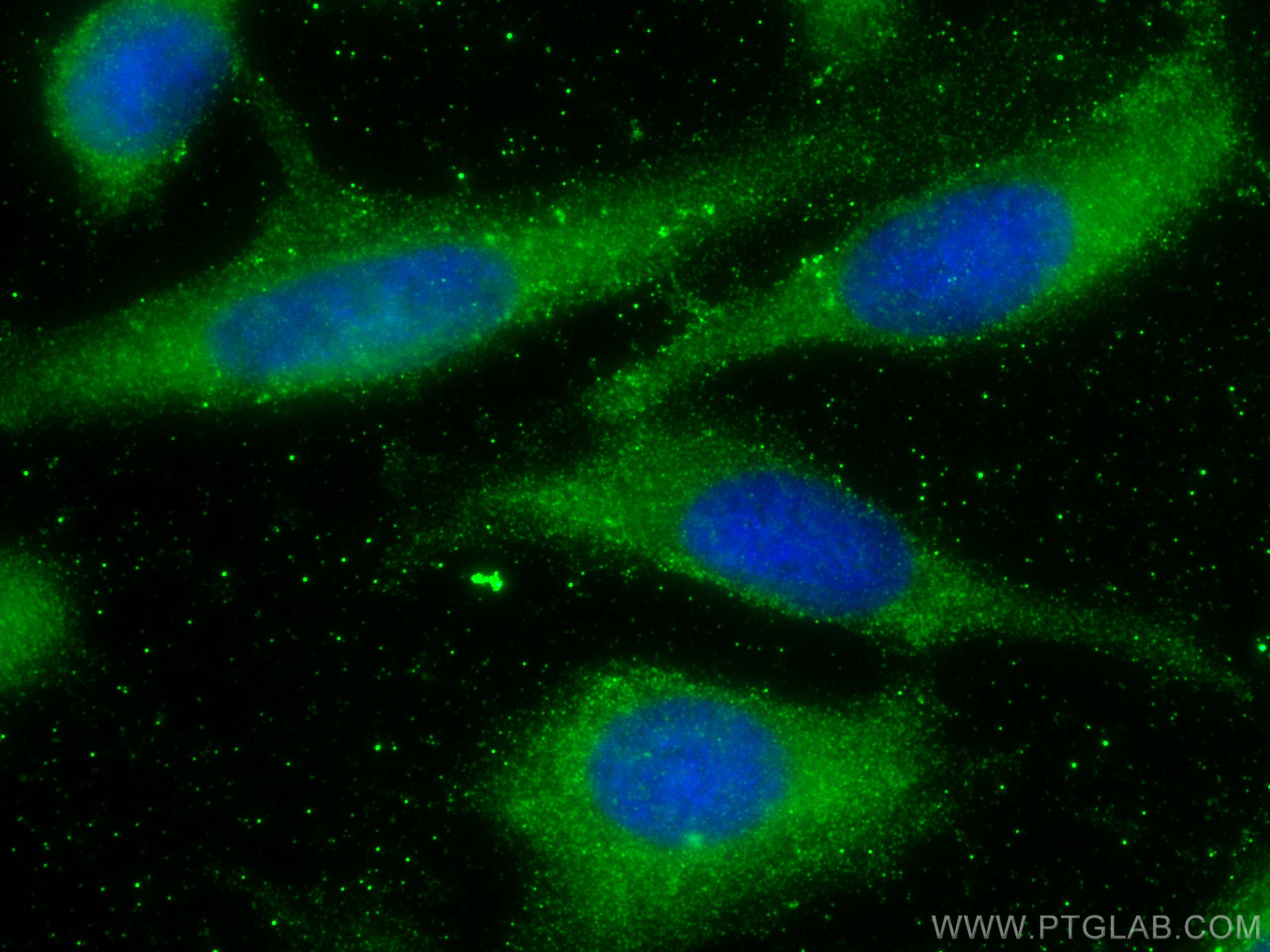 Immunofluorescence (IF) / fluorescent staining of U2OS cells using MAN1B1 Monoclonal antibody (68121-1-Ig)